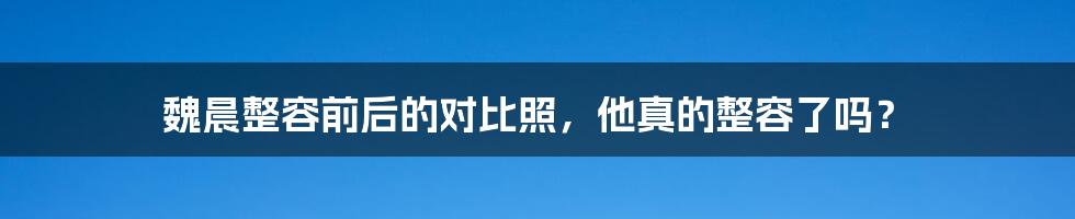 魏晨整容前后的对比照，他真的整容了吗？